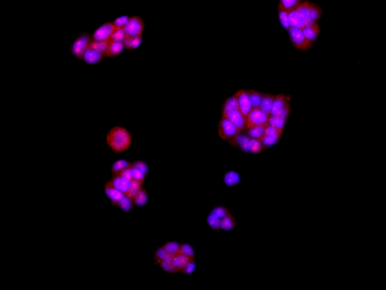 Immunofluorescence analysis of MCF7 cells using AMPK alpha2 Polyclonal Antibody at dilution of 1:100