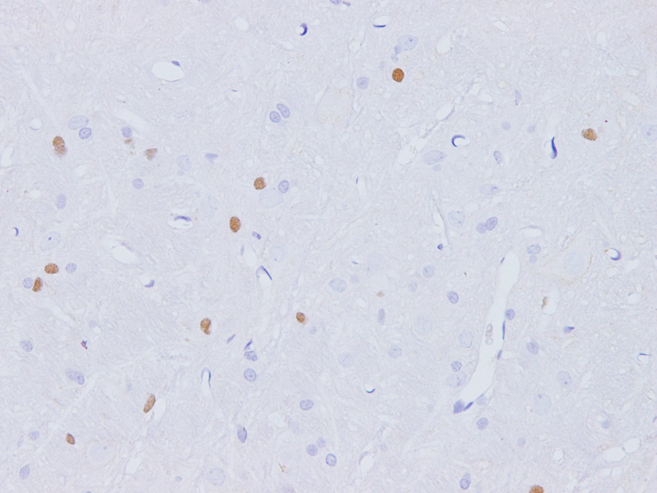 Immunohistochemistry of paraffin-embedded Rat brain using Fgf2 Polyclonal Antibody at dilution of 1:100