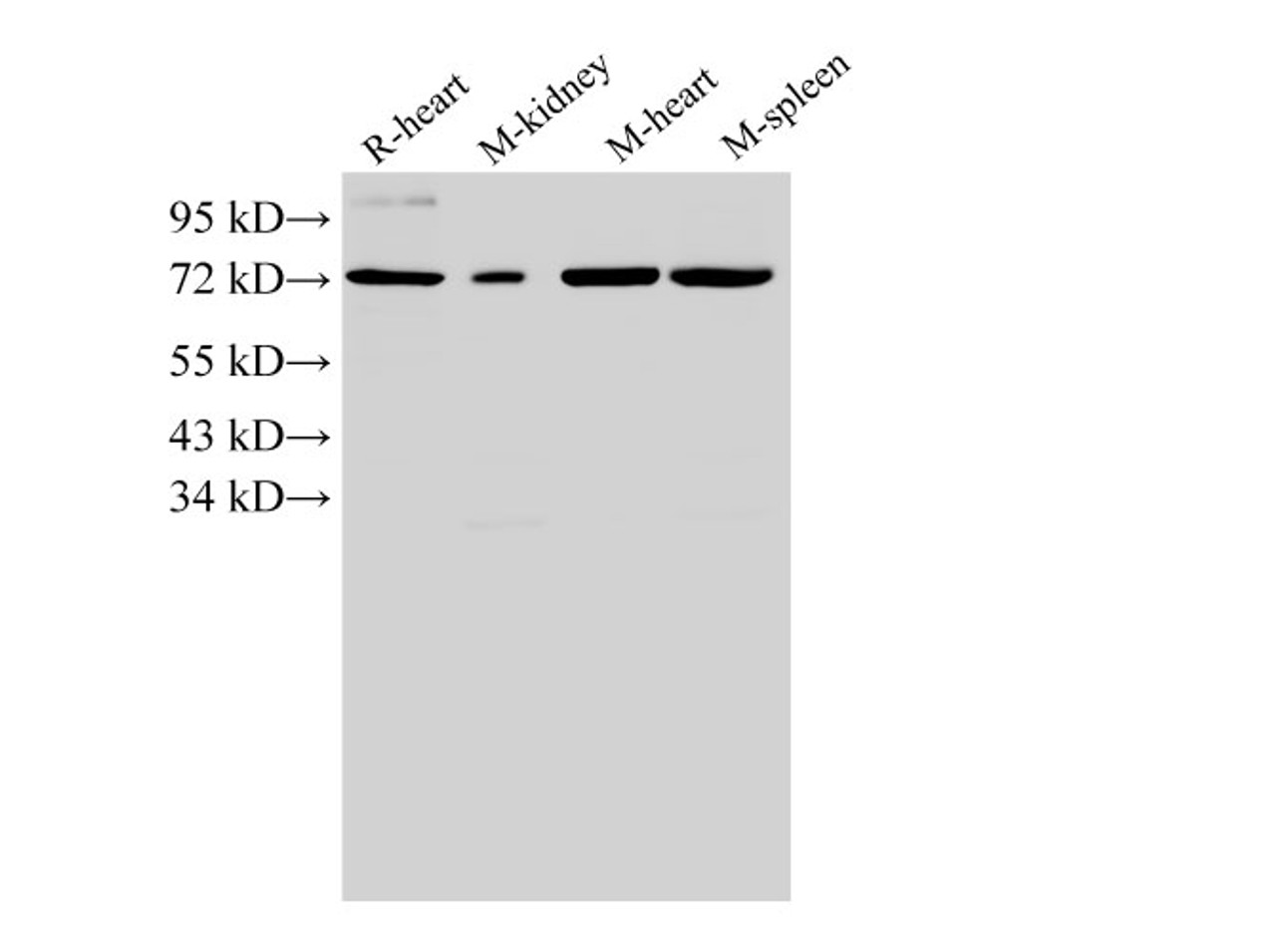 Western Blot analysis of Rat heart, Mouse kidney, Mouse heart and Mouse spleen using ANXA6 Polyclonal Antibody at dilution of 1:2000.