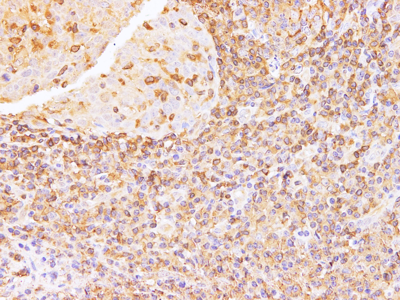 Immunohistochemistry of paraffin-embedded Human tonsil using Anxa6 Polyclonal Antibody at dilution of 1:100