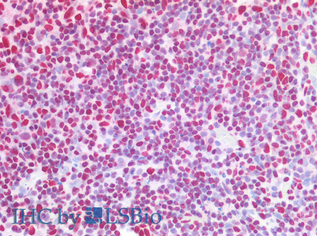 Immunohistochemistry of paraffin-embedded Human tonsil using CBX5 Polyclonal Antibody at dilution of 1:100(Elabscience® Product Detected by Lifespan).