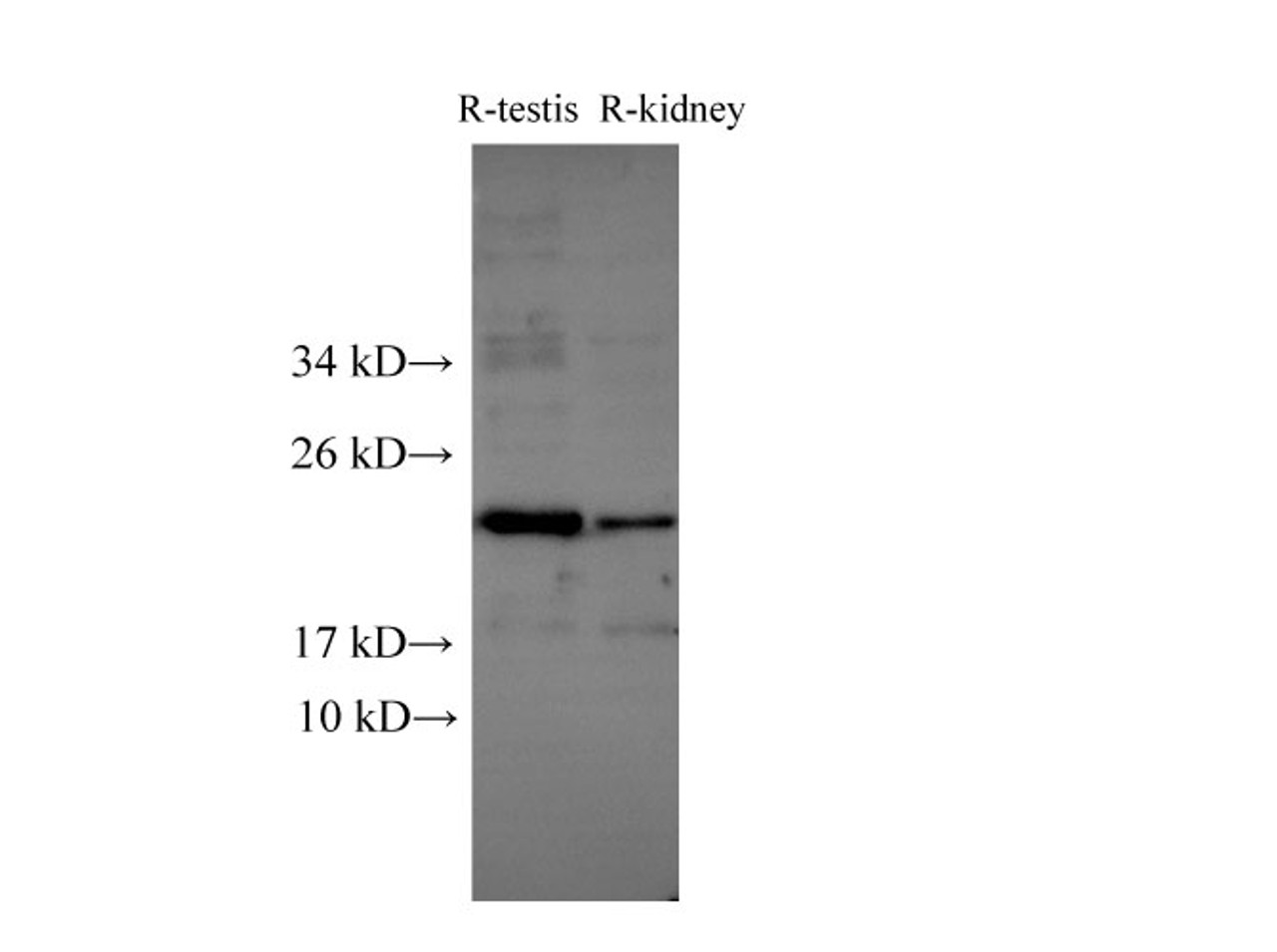 Western Blot analysis of Rat testis and Rat kidney using Runx2 Polyclonal Antibody at dilution of 1:500