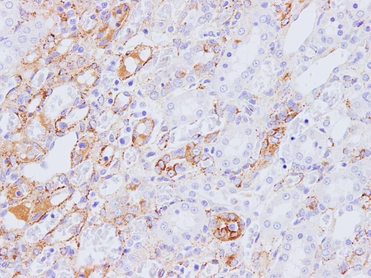 Immunohistochemistry of paraffin-embedded Rat kidney using IFITM3 Polyclonal Antibody at dilution of 1:100