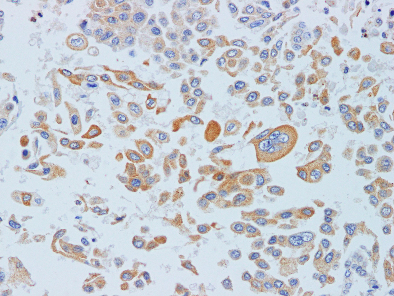 https://file.elabscience.com//image/antibody/EA/E-AB-40263-IHC03.jpg