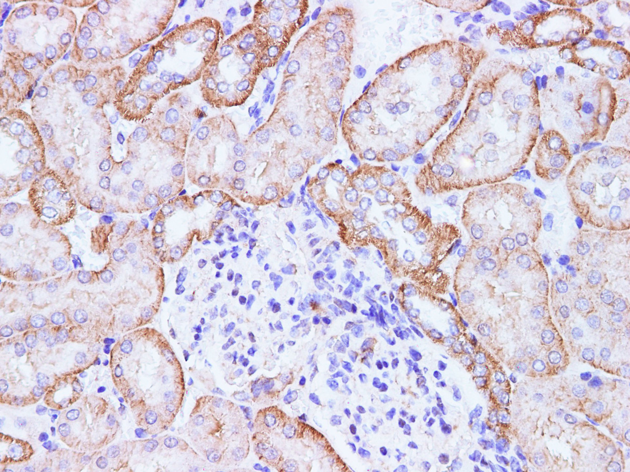 Immunohistochemistry of paraffin-embedded Mouse kidney using CCL2 Polyclonal Antibody at dilution of 1:100