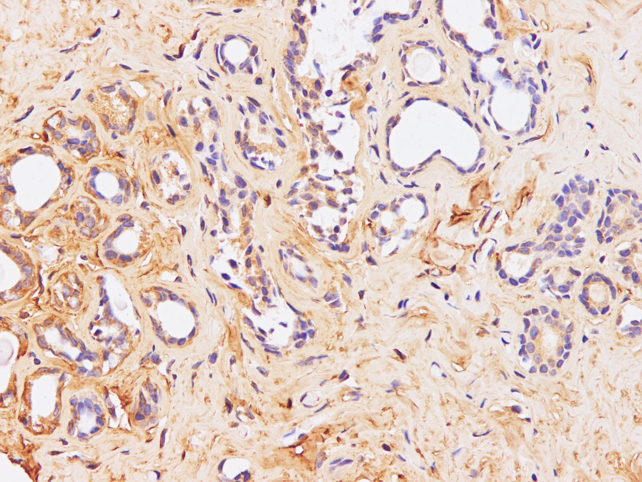 Immunohistochemistry of paraffin-embedded Human breast  using POSTN Polyclonal Antibody at dilution of 1:100