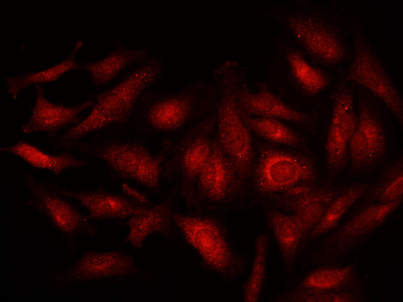 Immunofluorescence analysis of Hela cells  using POSTN Polyclonal Antibody at dilution of 1:100