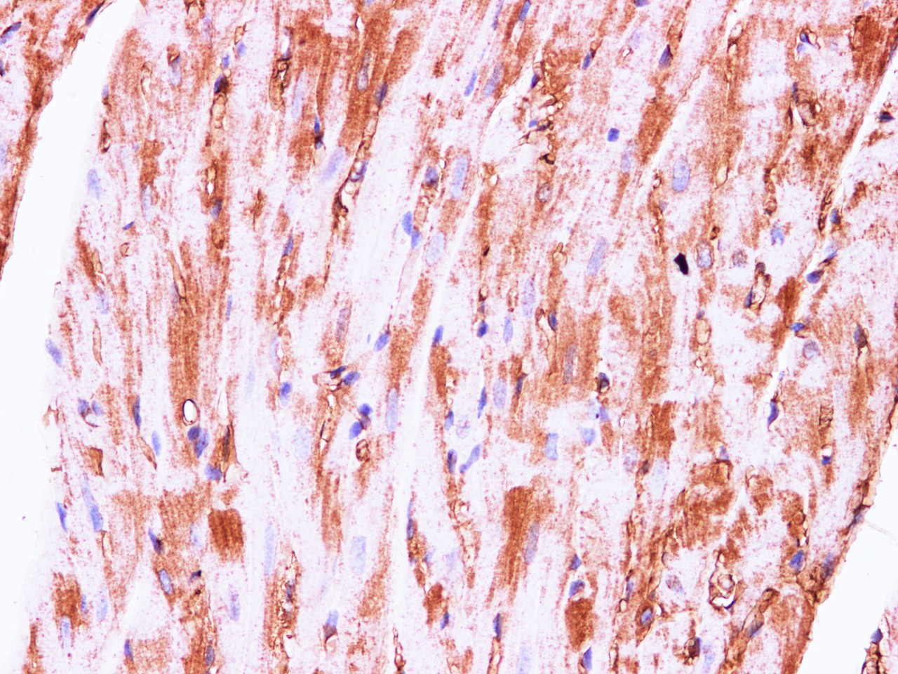 Immunohistochemistry of paraffin-embedded Rat heart using Serpina1 Polyclonal Antibody at dilution of 1:100