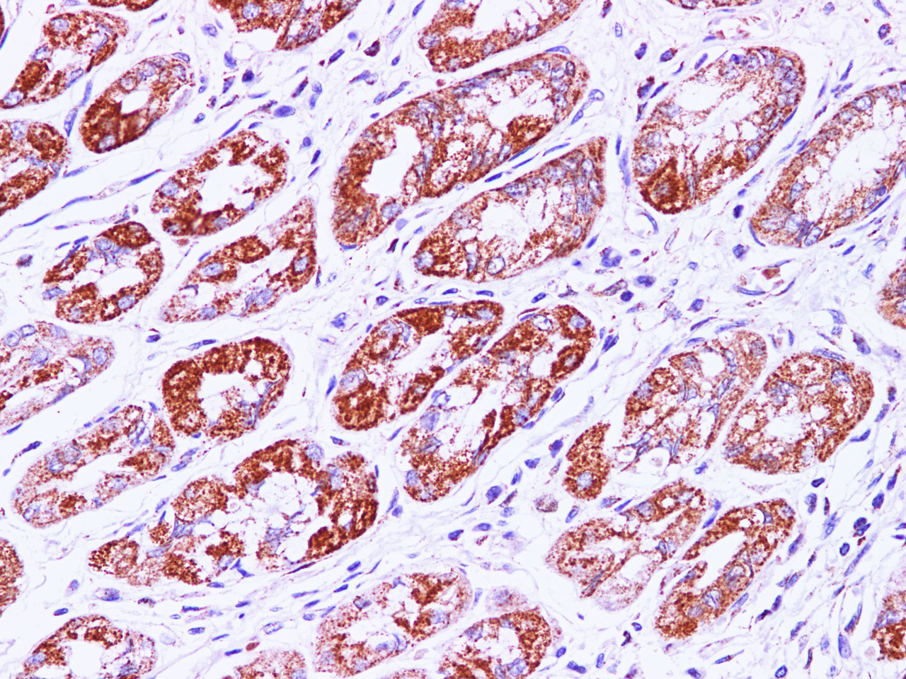 Immunohistochemistry of paraffin-embedded Human stomach using IHH Polyclonal Antibody at dilution of 1:100(400×)