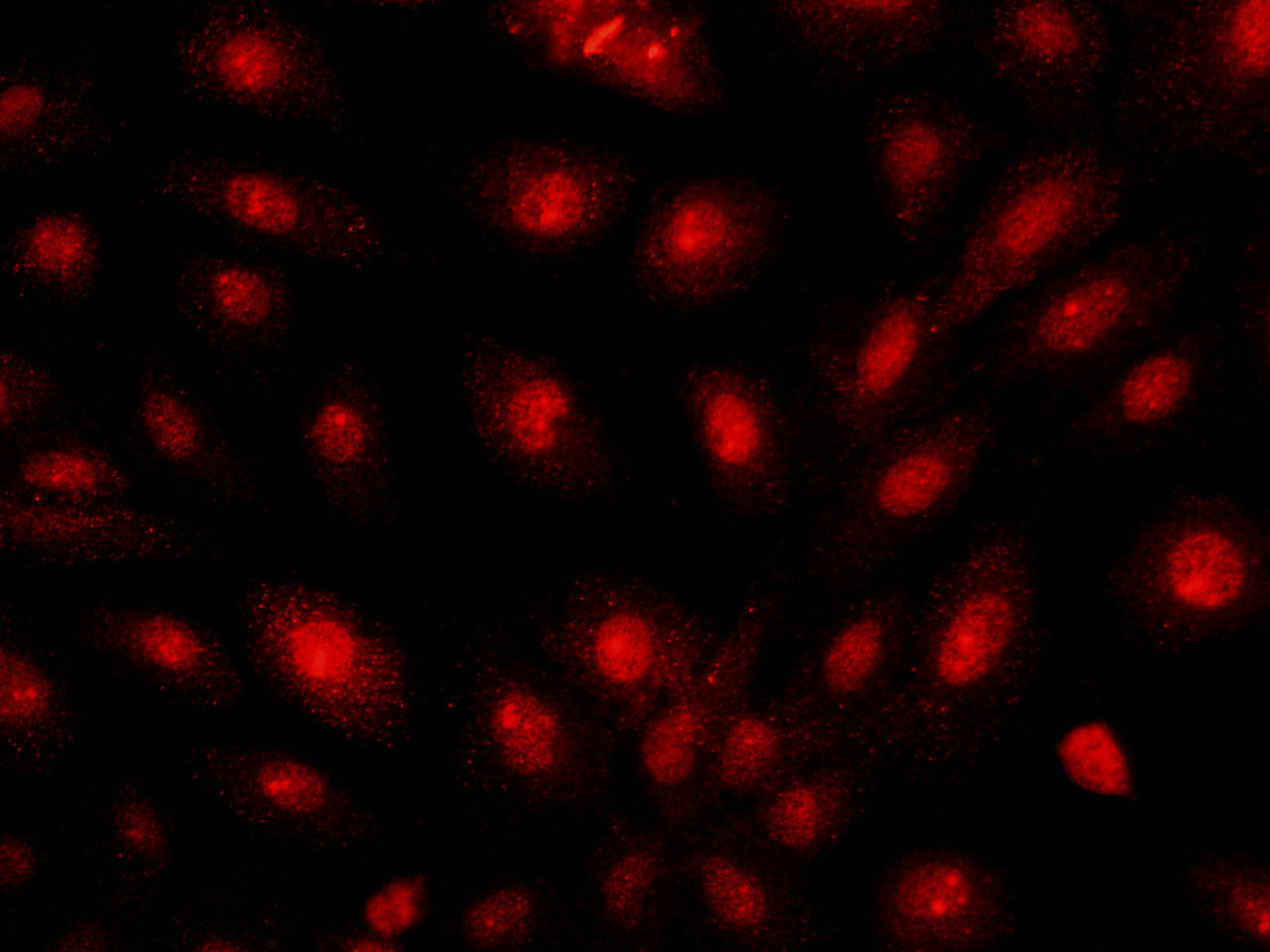 Immunofluorescence analysis of U-2OS cells  using BRCA1 Polyclonal Antibody at dilution of 1:100