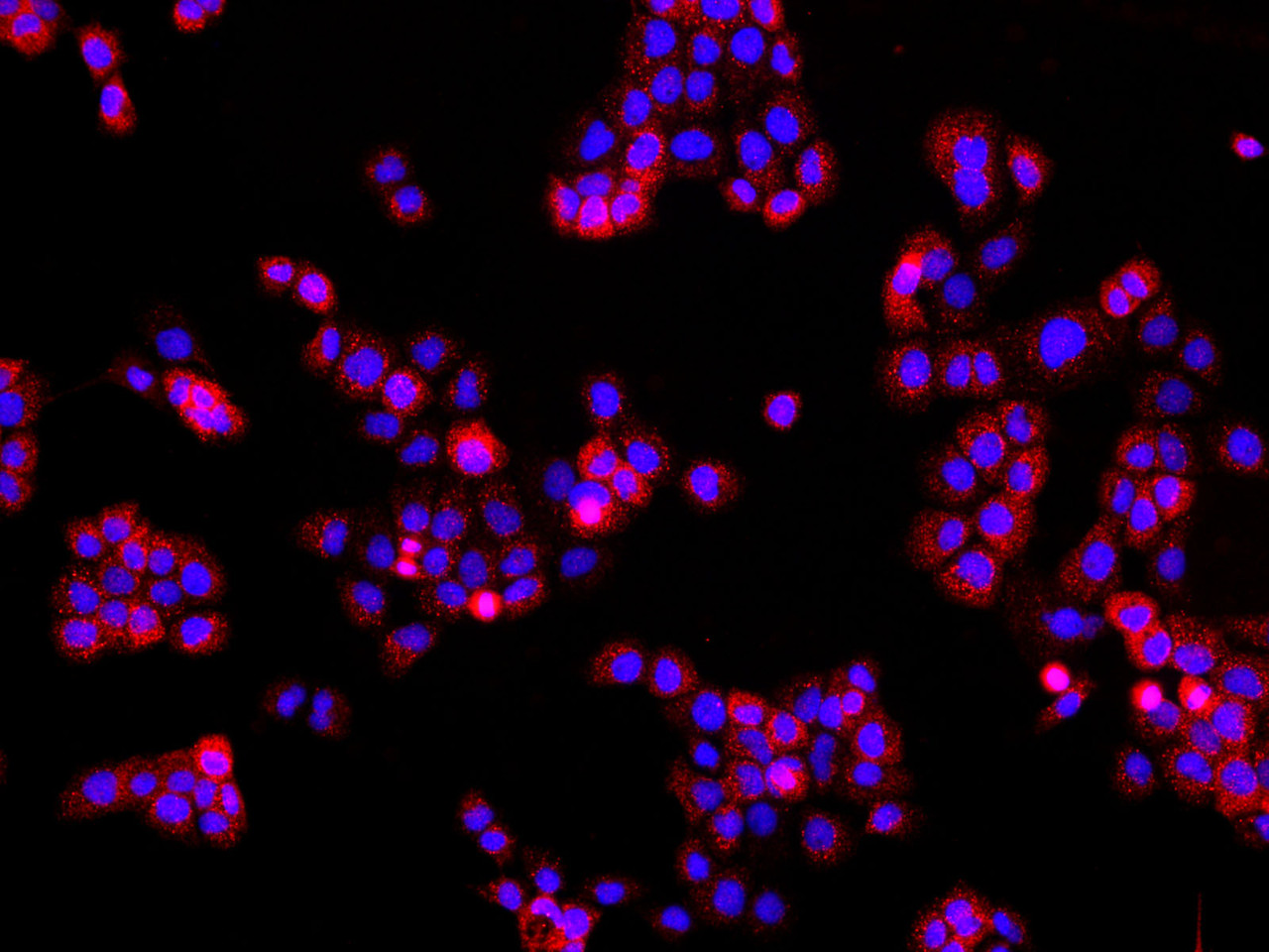 Immunofluorescence analysis of A431 cells  using EGFR Polyclonal Antibody at dilution of 1:100