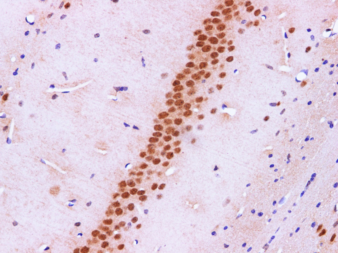 https://file.elabscience.com//image/antibody/EA/E-AB-40284-IHC02.jpg