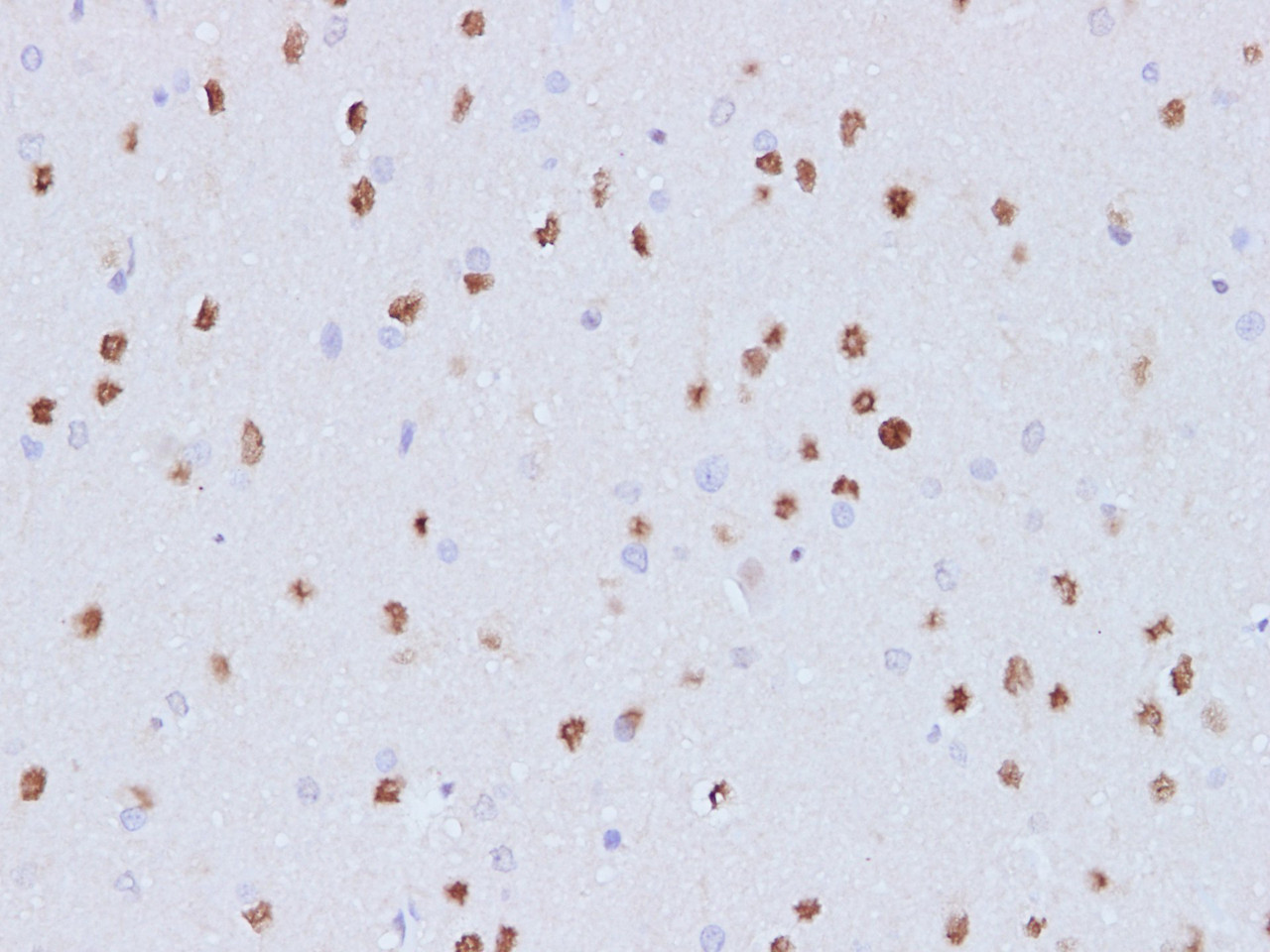 Immunohistochemistry of paraffin-embedded Rat brain using PTEN Polyclonal Antibody at dilution of 1:100