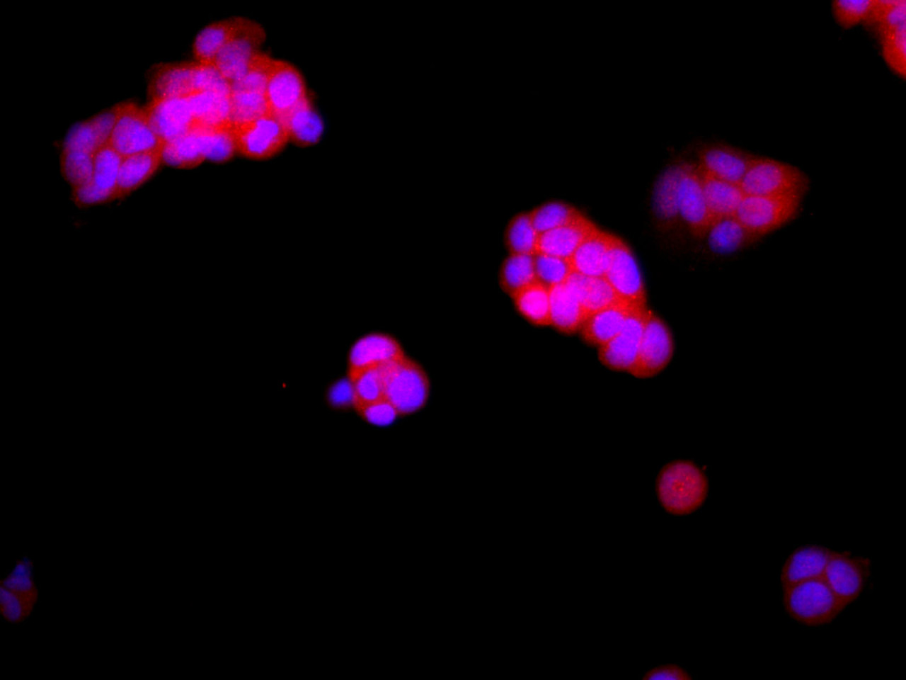 Immunofluorescence analysis of McF7 cells using PTEN Polyclonal Antibody at dilution of 1:100