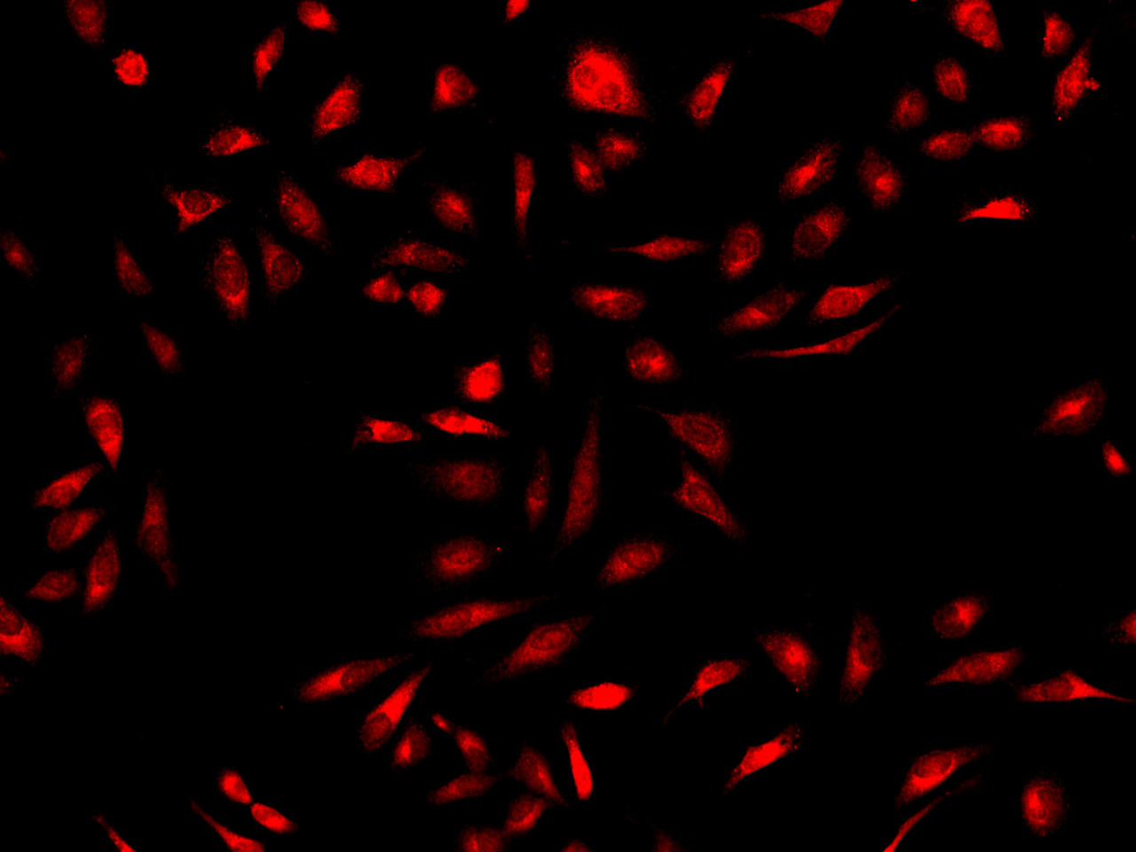 Immunofluorescence analysis of Hela cells  using GSTM1 Polyclonal Antibody at dilution of 1:100