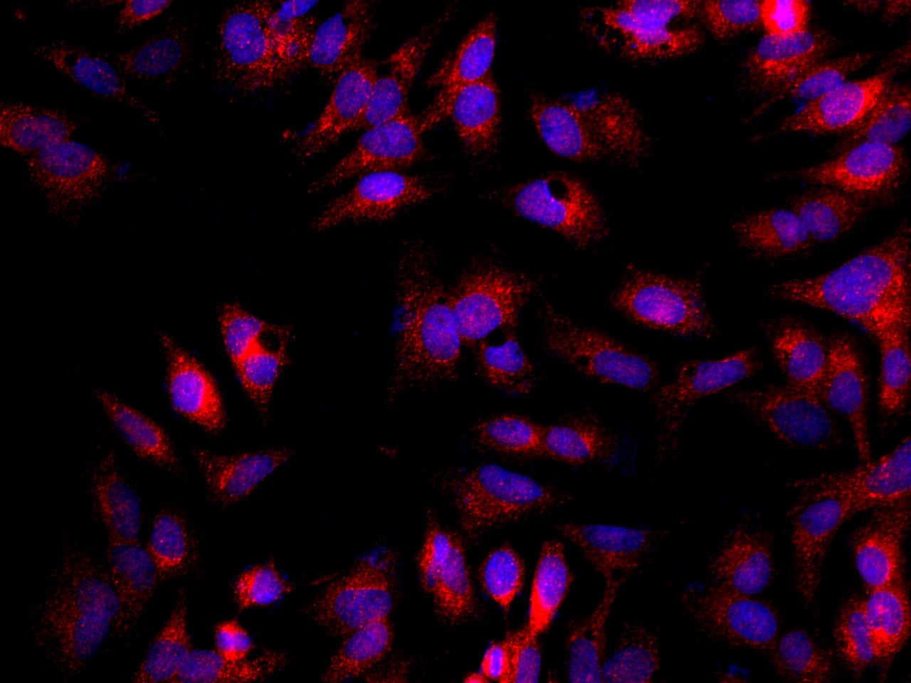 Immunofluorescence analysis of HepG2 cells  using GSTM1 Polyclonal Antibody at dilution of 1:100