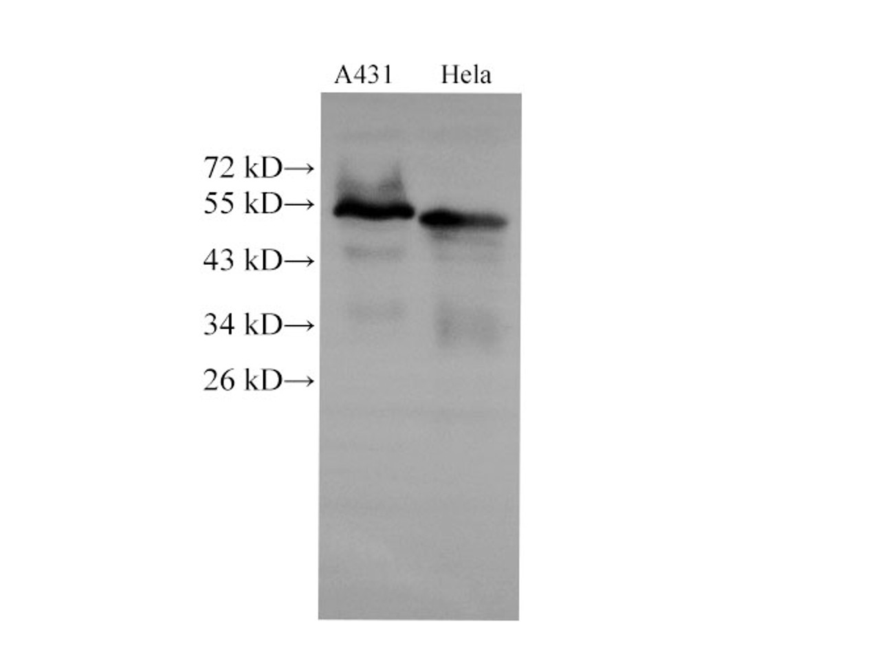 Western Blot analysis of A431 and Hela cells  using CK-7 Polyclonal Antibody at dilution of 1:2000