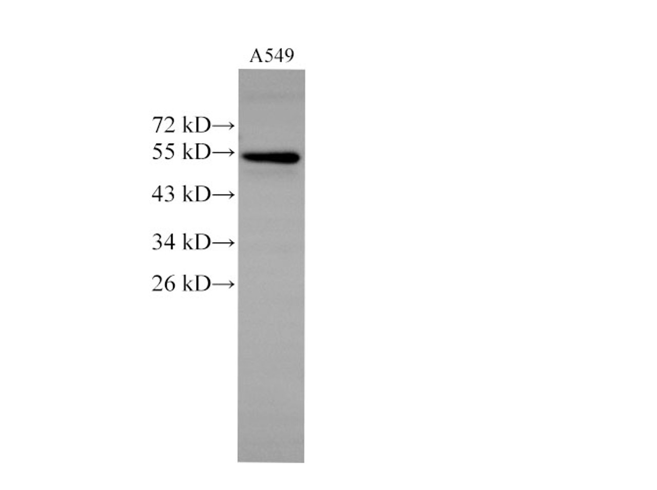 Western Blot analysis of A549 cells  using CK-7 Polyclonal Antibody at dilution of 1:2000