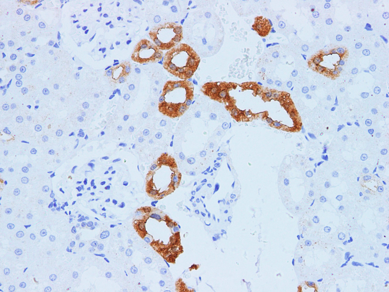 https://file.elabscience.com//image/antibody/EA/E-AB-40296-IHC04.jpg