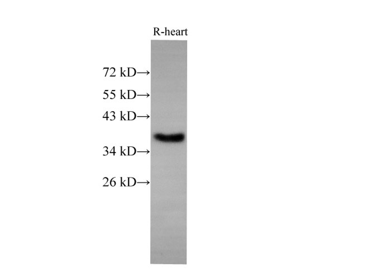 Western Blot analysis of Rat Heart using EpCAM Polyclonal Antibody at dilution of 1:500