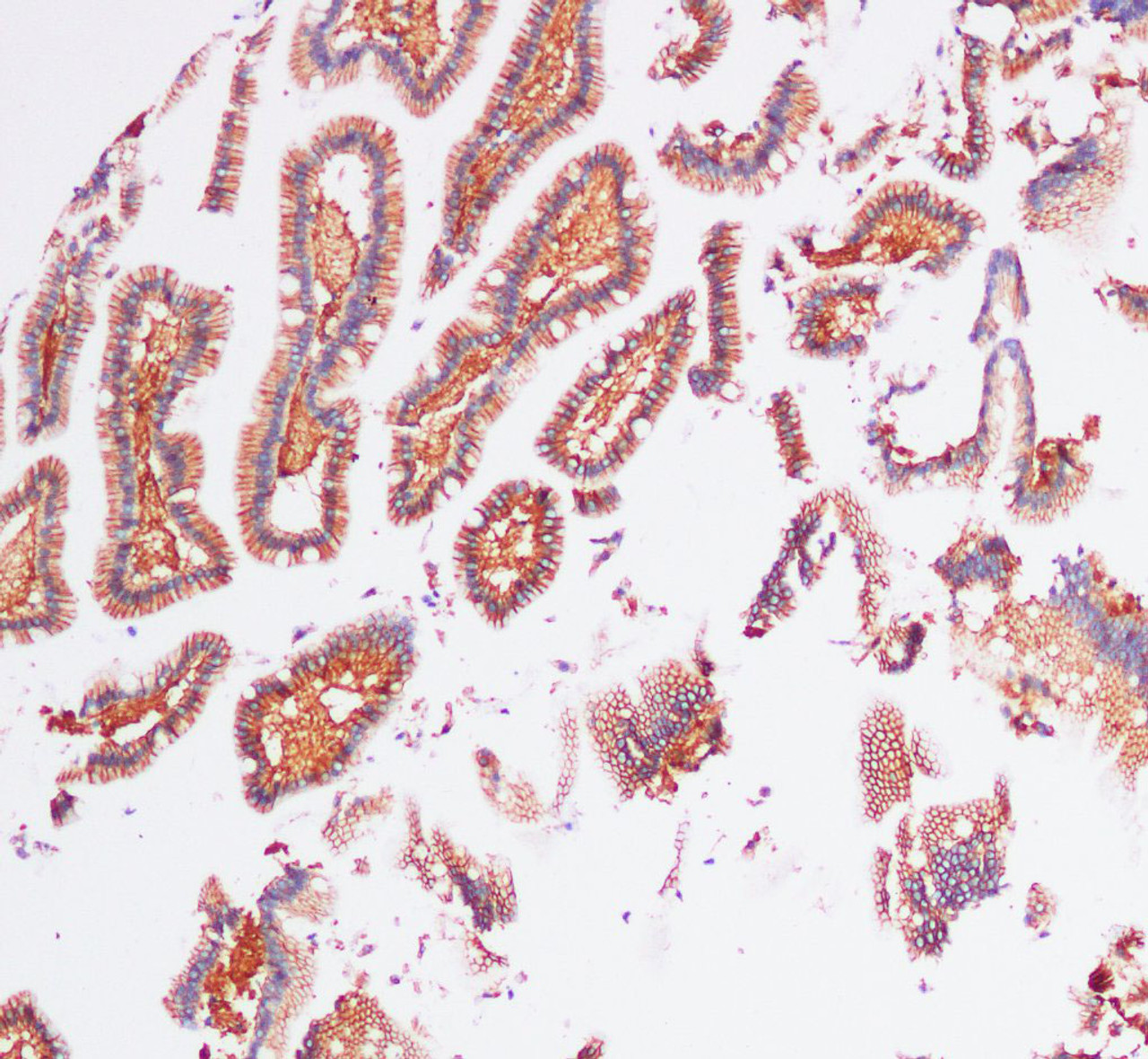 Immunohistochemistry of paraffin-embedded Human Duodenum using EpCAM Polyclonal Antibody at dilution of 1:100(100×)