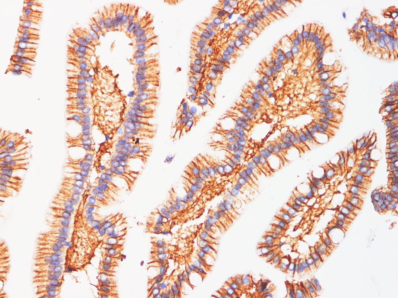 https://file.elabscience.com//image/antibody/EA/E-AB-40300-IHC02.jpg