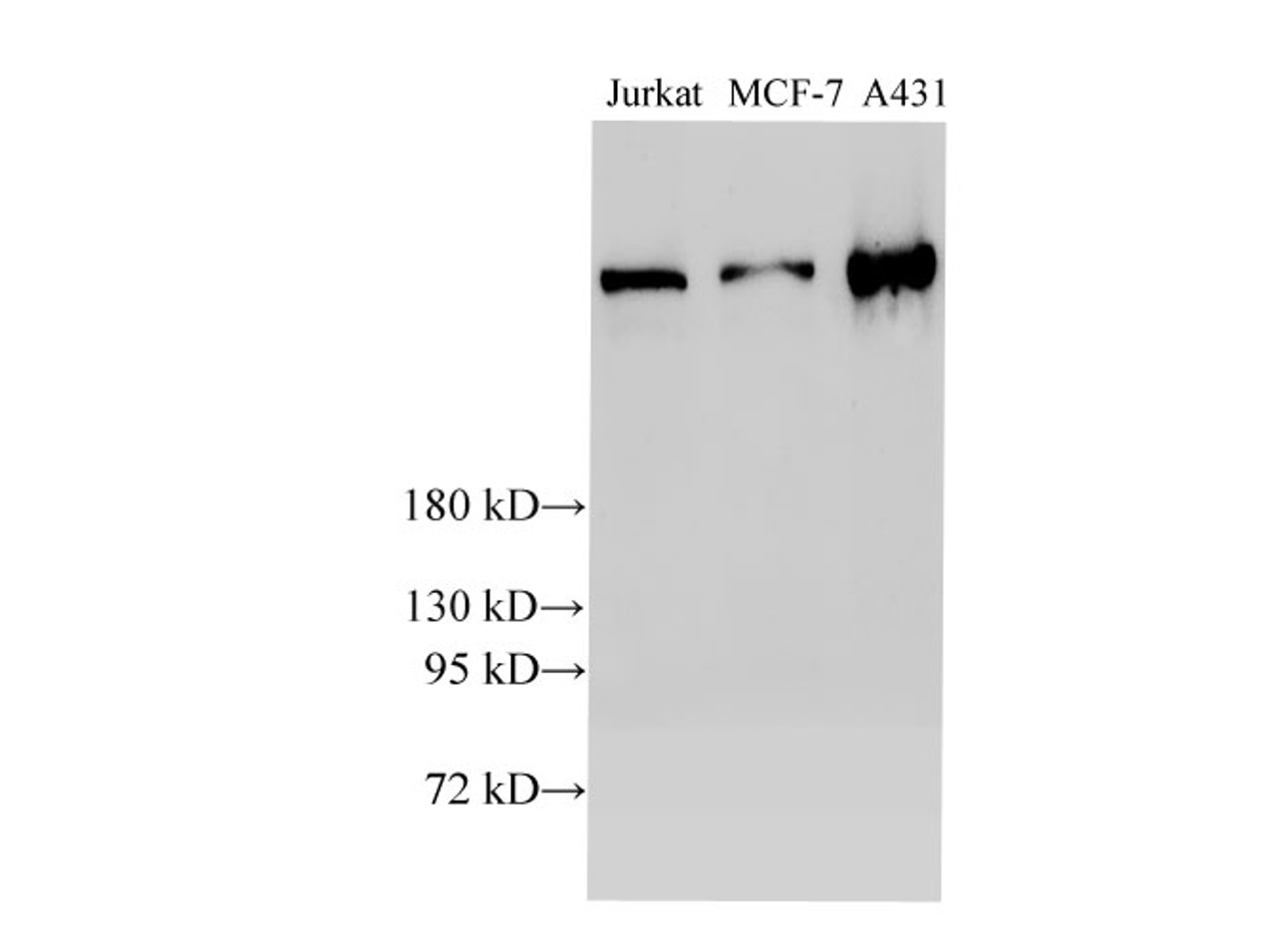 Western Blot analysis of Jurkat, MCF-7 and A431 cells using BRCA2 Polyclonal Antibody at dilution of 1:2000