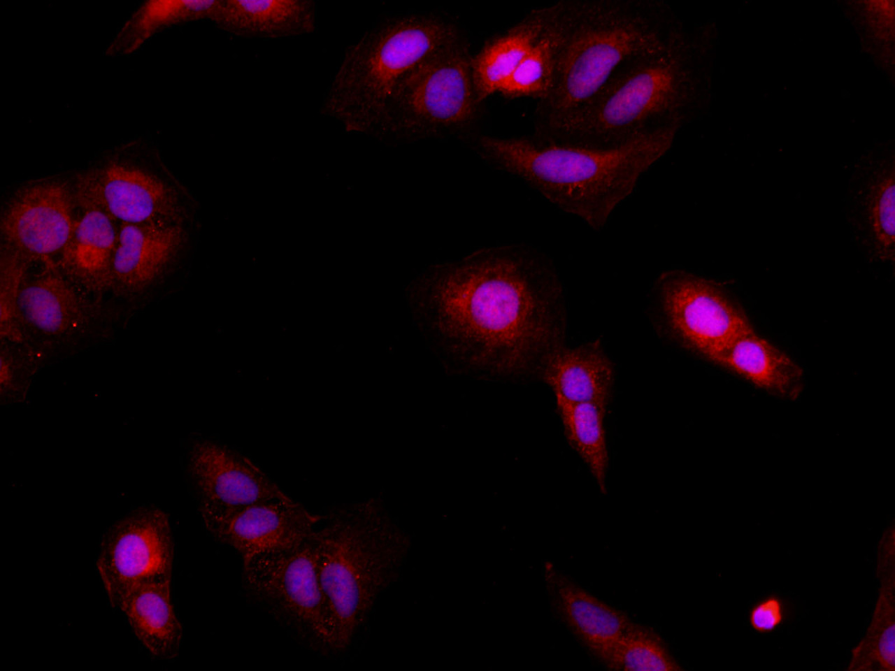 Immunofluorescence analysis of U-2OS cells  using BRCA2 Polyclonal Antibody at dilution of 1:100