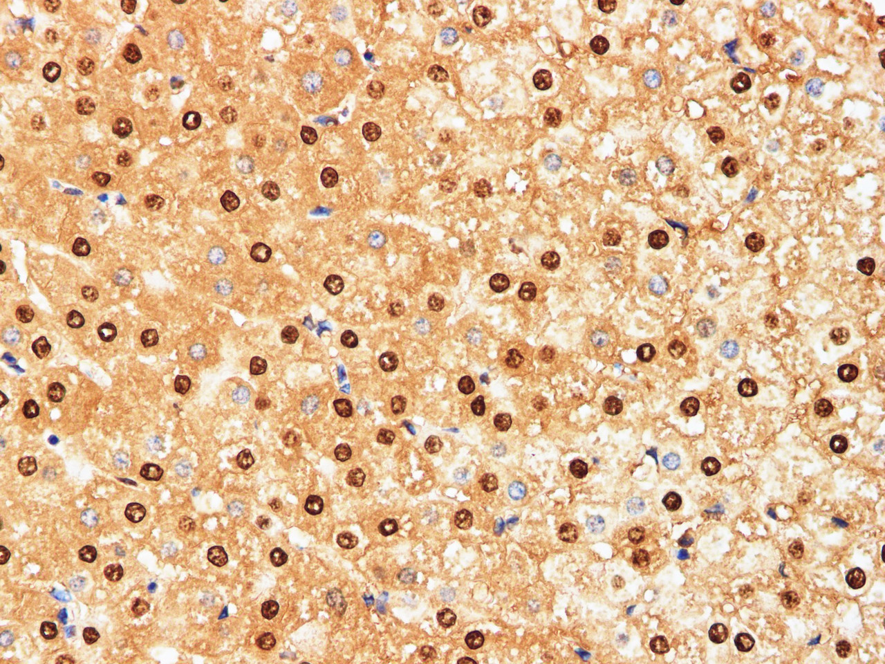 Immunohistochemistry of paraffin-embedded Human liver using HSPA1A Polyclonal Antibody at dilution of 1:200