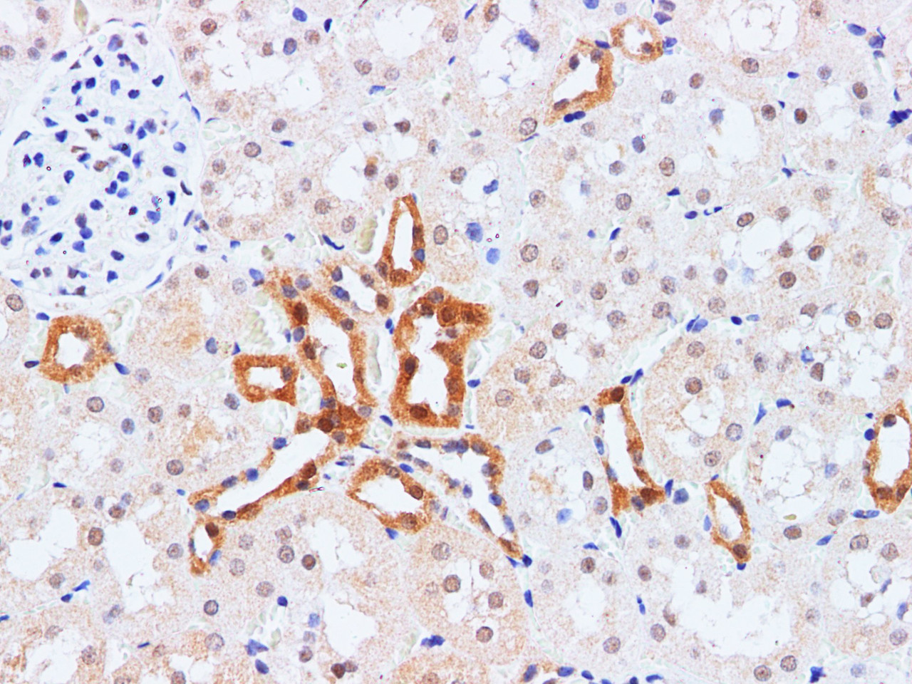 https://file.elabscience.com//image/antibody/EA/E-AB-40302-IHC02.jpg