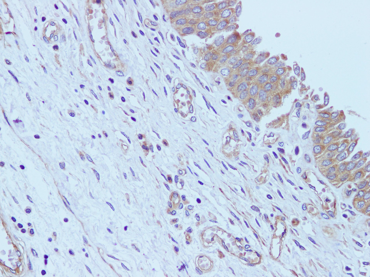 Immunohistochemistry of paraffin-embedded Human urinary bladder using CD59 Polyclonal Antibody at dilution of 1:100
