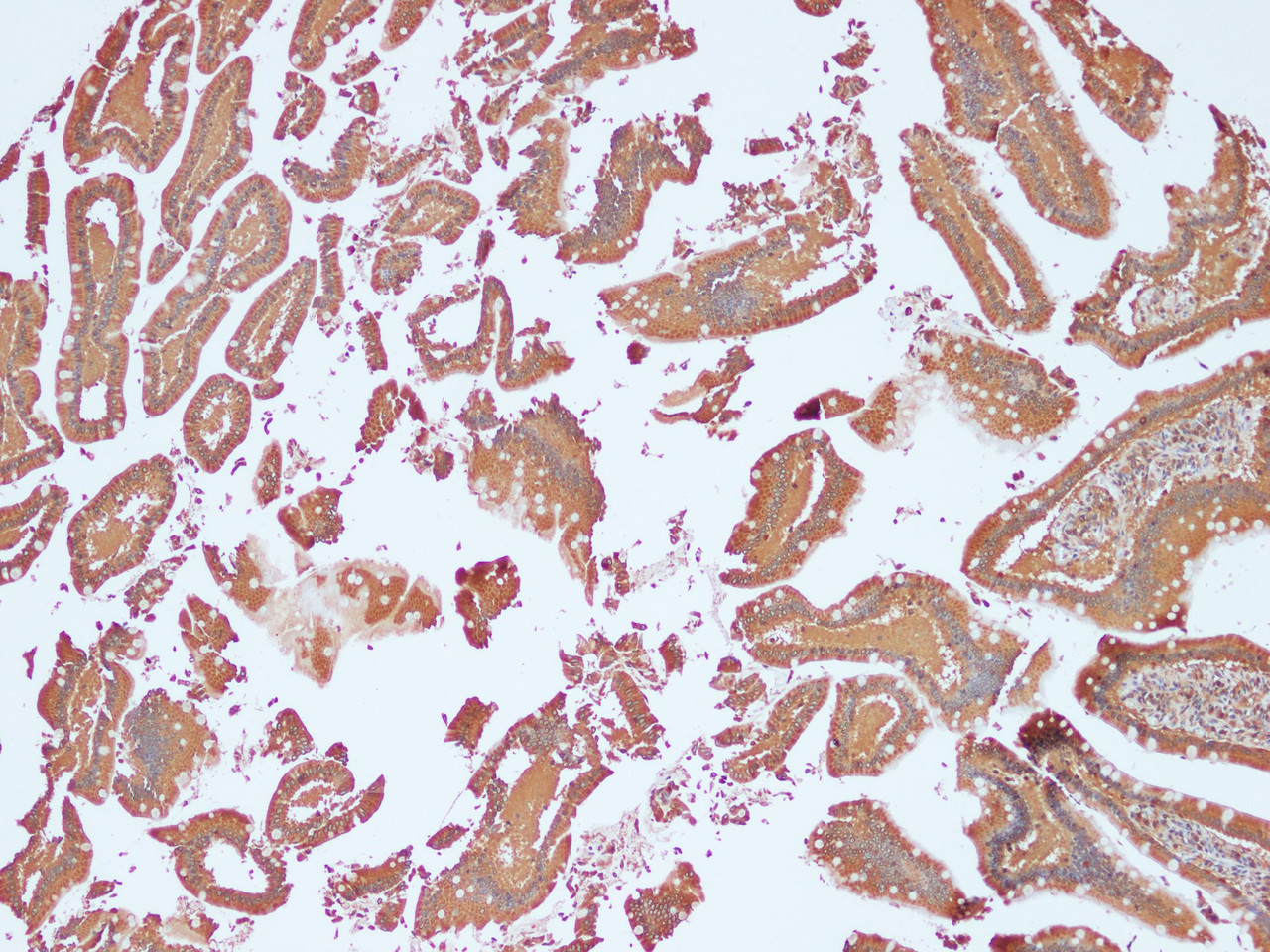 Immunohistochemistry of paraffin-embedded Human duodenum using NRAS Polyclonal Antibody at dilution of 1:100(100×)