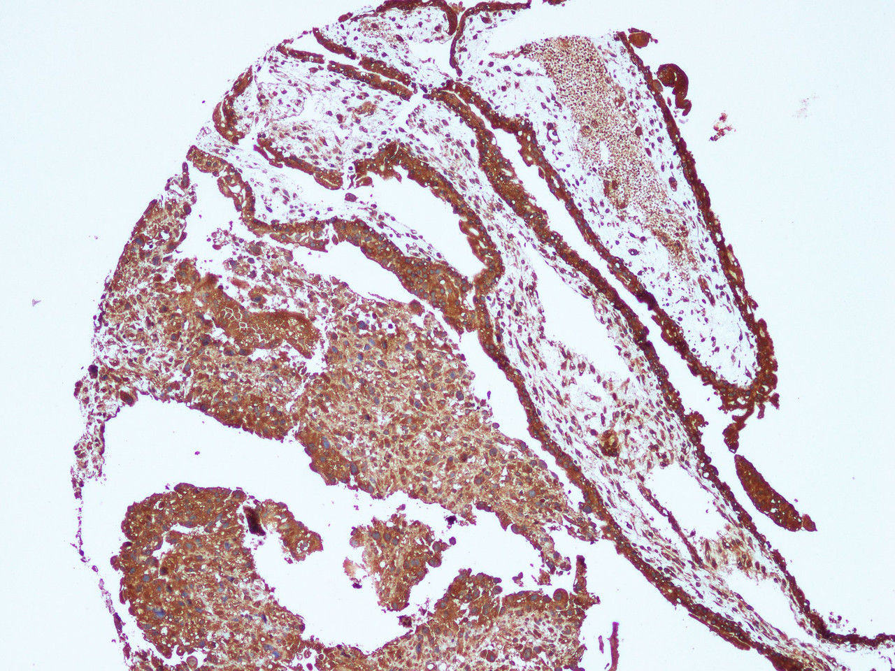 Immunohistochemistry of paraffin-embedded Human placenta using FLT1 Polyclonal Antibody at dilution of 1:100(100×)