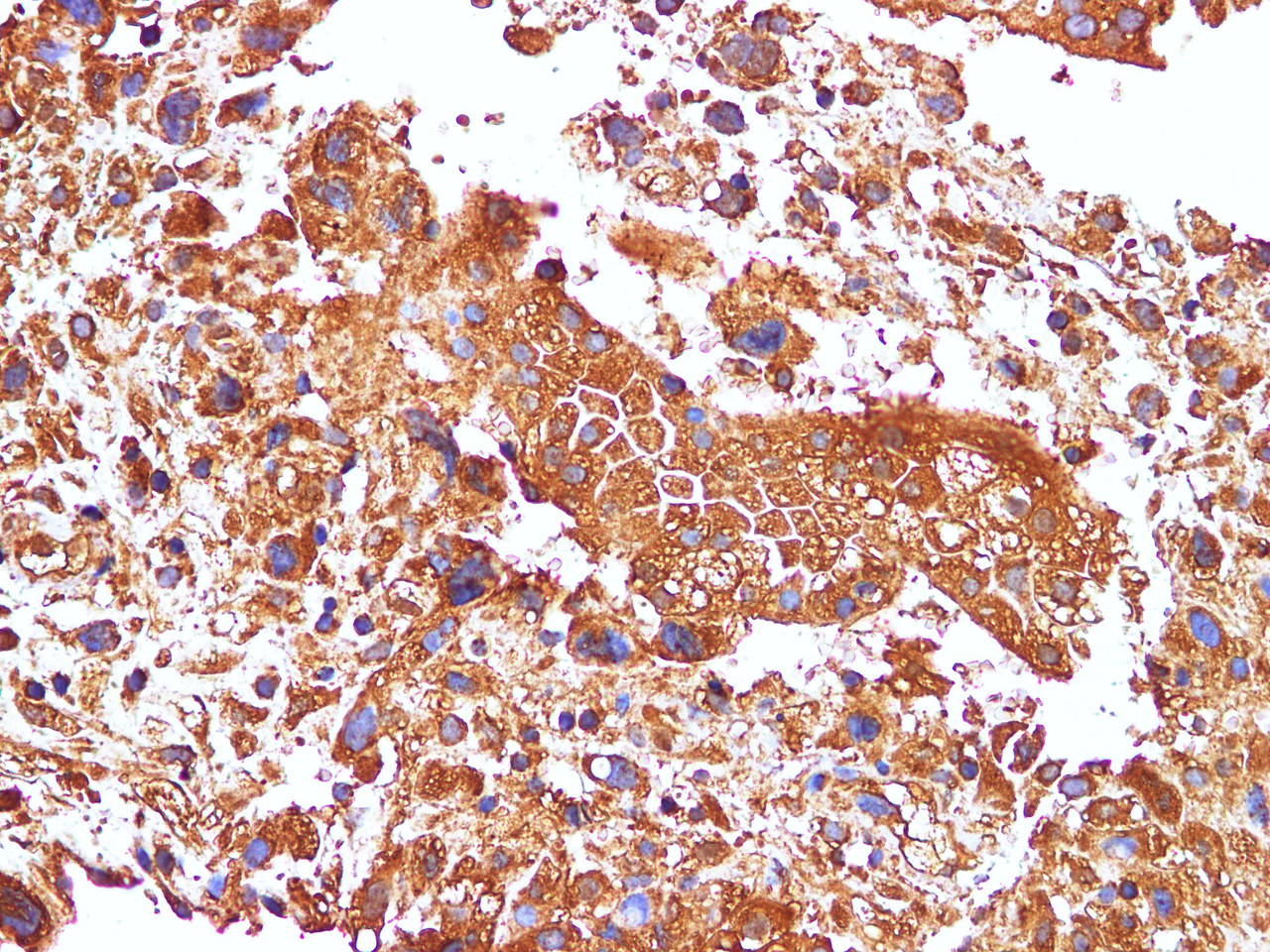 Immunohistochemistry of paraffin-embedded Human placenta using FLT1 Polyclonal Antibody at dilution of 1:100(400×)