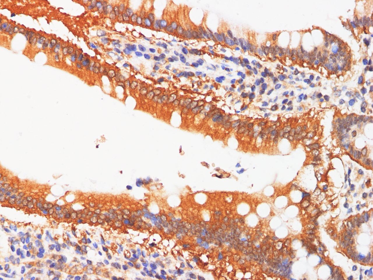 Immunohistochemistry of paraffin-embedded Human Duodenum using IFNAR1 Polyclonl Antibody at dilution of 1:200.
