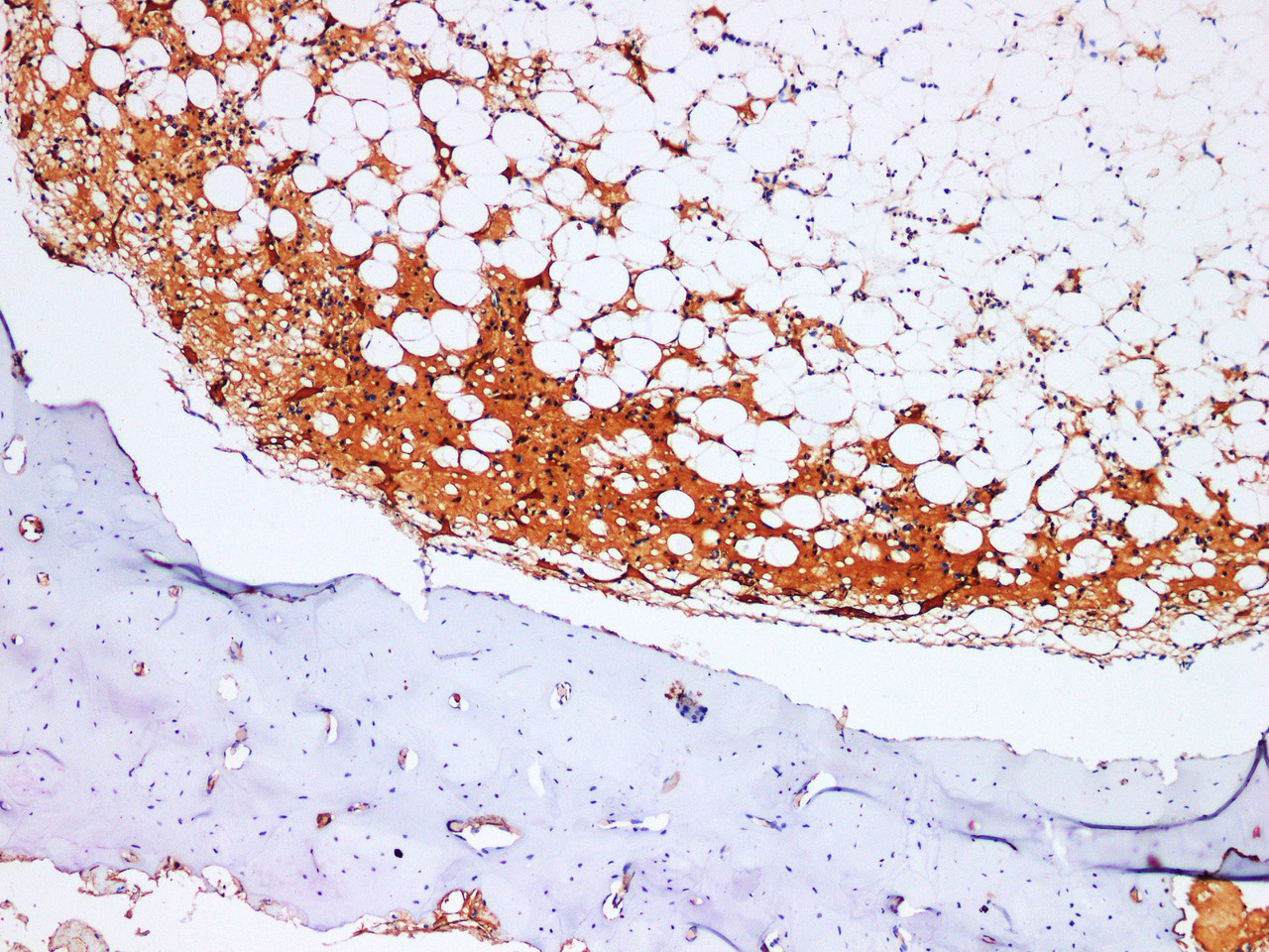 Immunohistochemistry of paraffin-embedded Mouse Skeletal muscle using TIMP1 Polyclonl Antibody at dilution of 1:200.