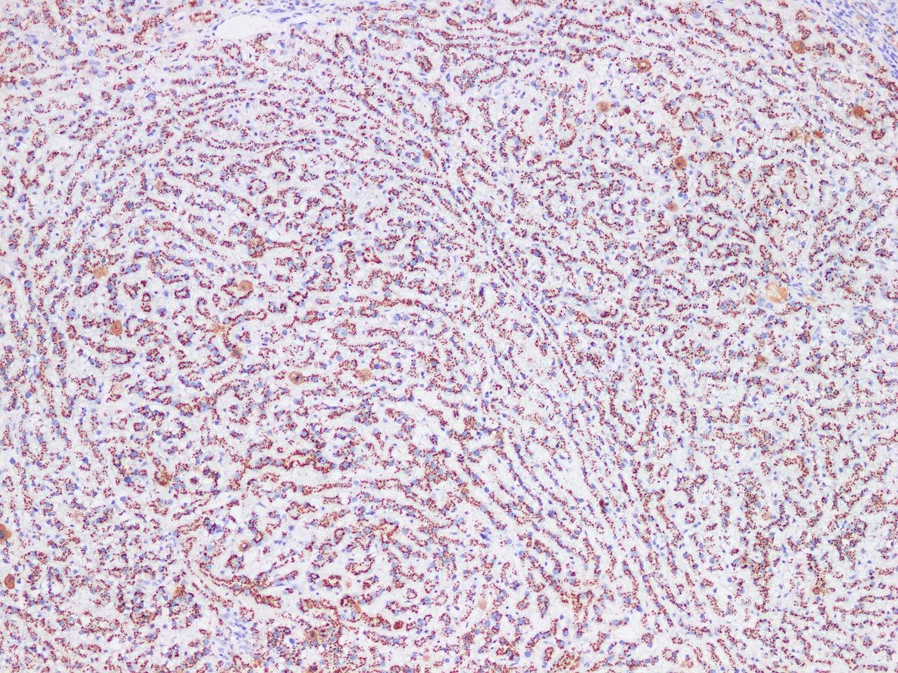 Immunohistochemistry of paraffin-embedded Rat liver using CD75 Polyclonl Antibody at dilution of 1:200(100×).