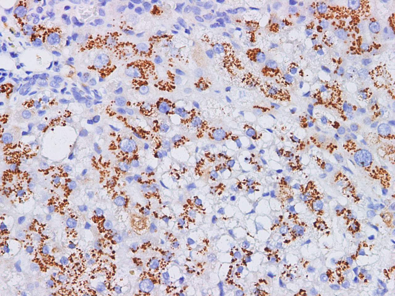 Immunohistochemistry of paraffin-embedded Rat liver using CD75 Polyclonl Antibody at dilution of 1:200(400×).