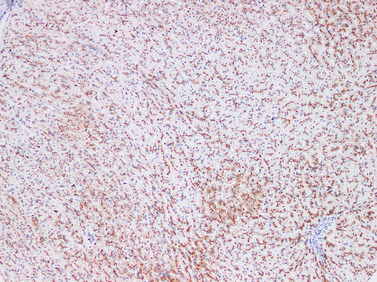 Immunohistochemistry of paraffin-embedded Human liver using CD75 Polyclonl Antibody at dilution of 1:200(100×).