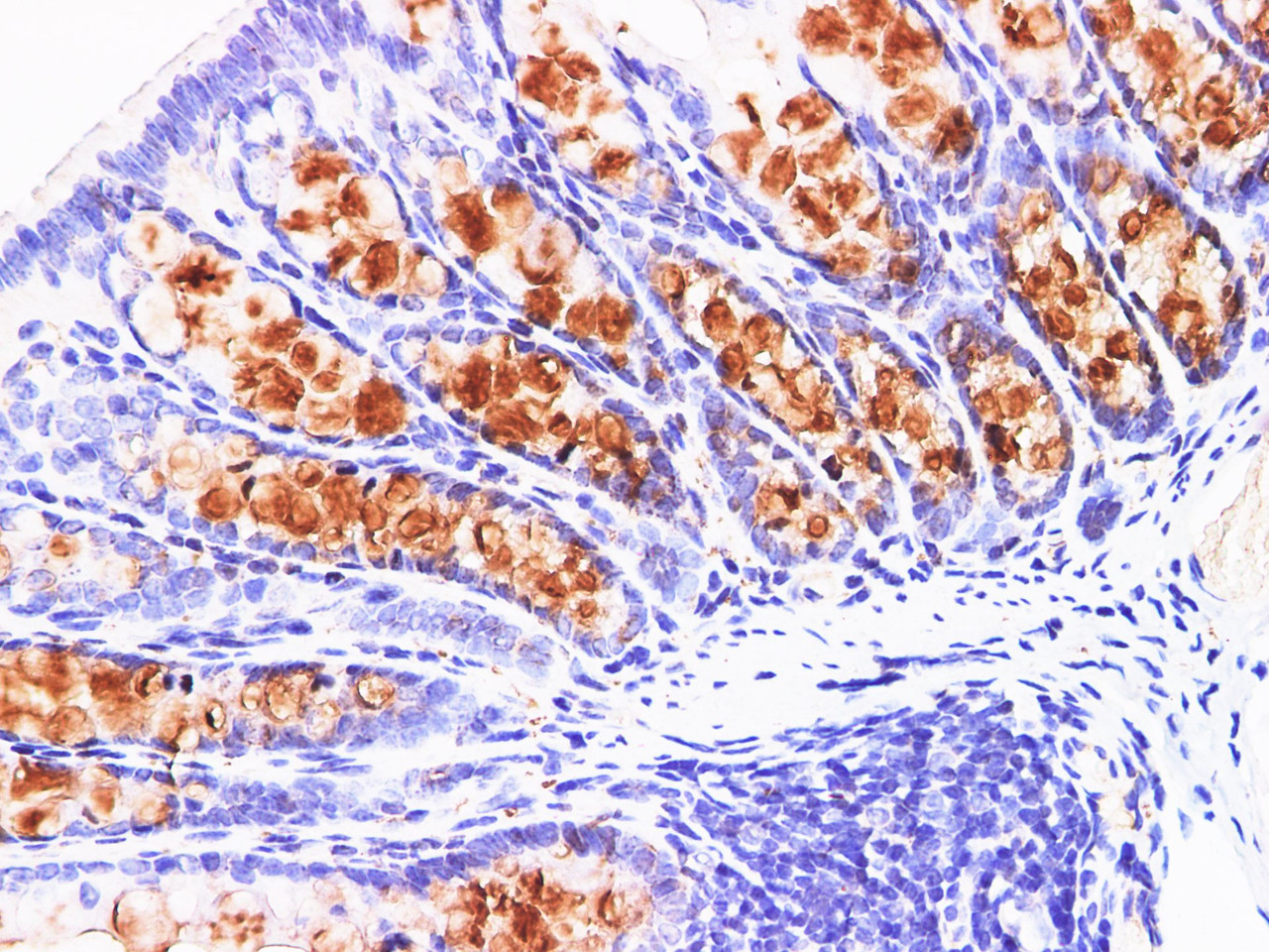 https://file.elabscience.com//image/antibody/EA/E-AB-40314-IHC04.jpg