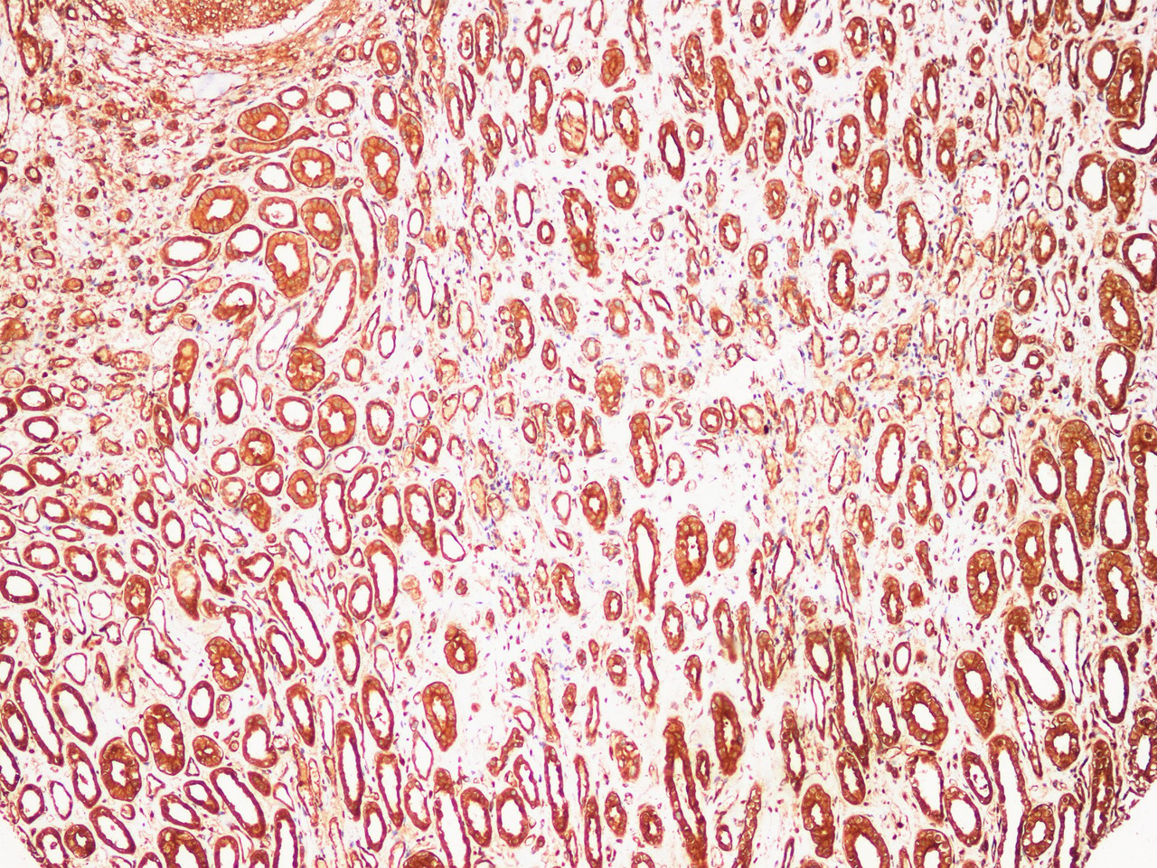 Immunohistochemistry of paraffin-embedded Human kidney using S100A9 Polyclonl Antibody at dilution of 1:200.