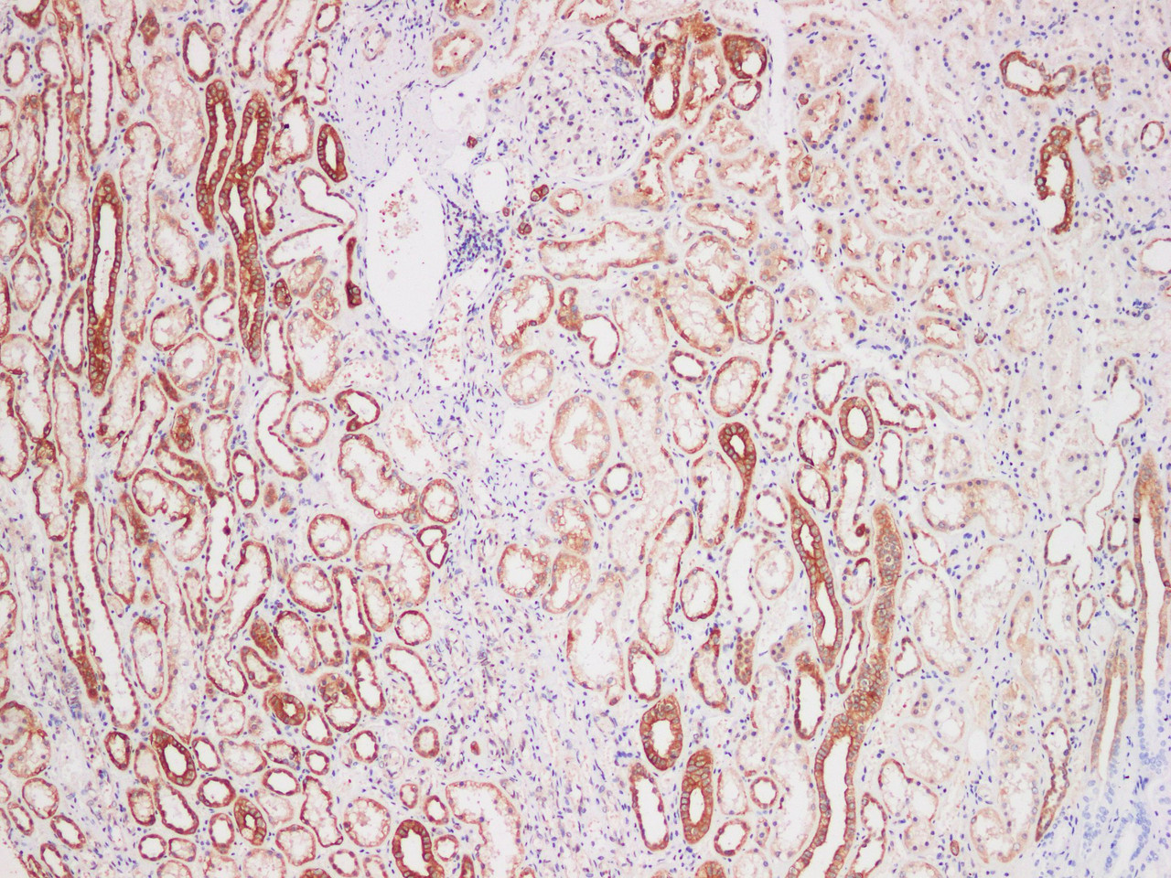 Immunohistochemistry of paraffin-embedded Human kidney using LAMP3 Polyclonl Antibody at dilution of 1:200.
