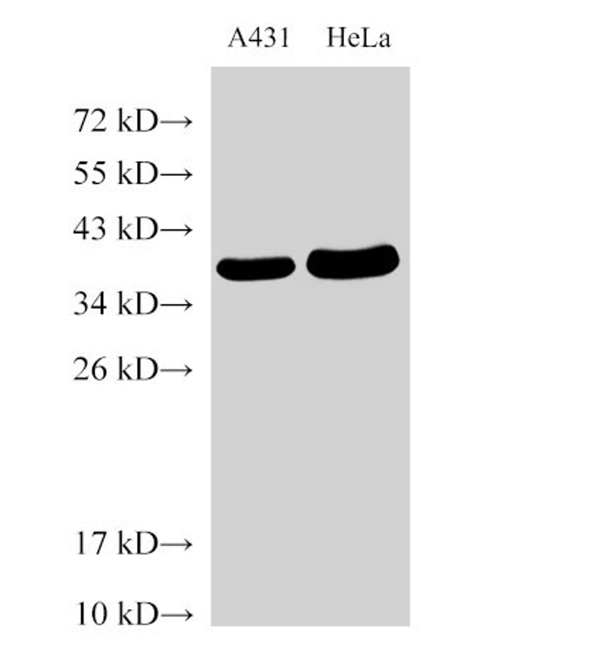 Western Blot analysis of A431 and Hela cells using GAPDH Polyclonal Antibody at dilution of 1:5000