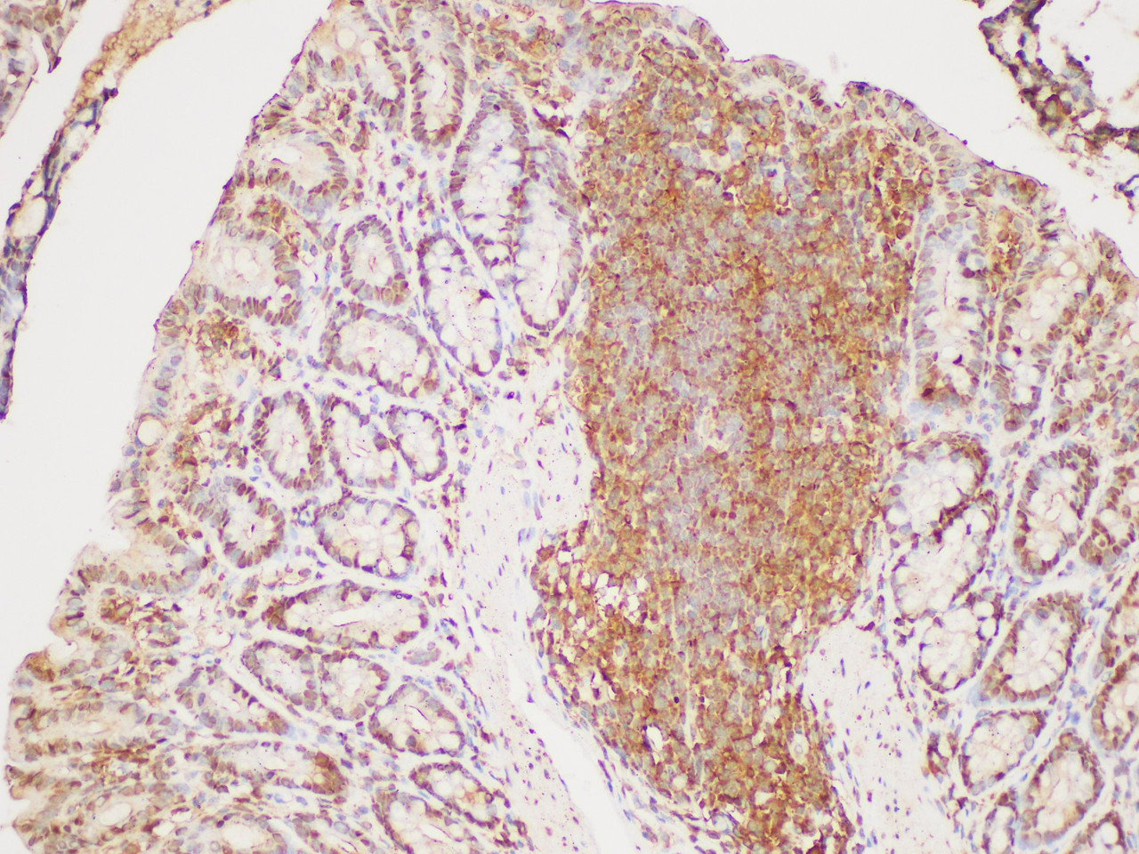Immunohistochemistry of paraffin-embedded Rat colon using GAPDH Polyclonal Antibody at dilution of 1:400