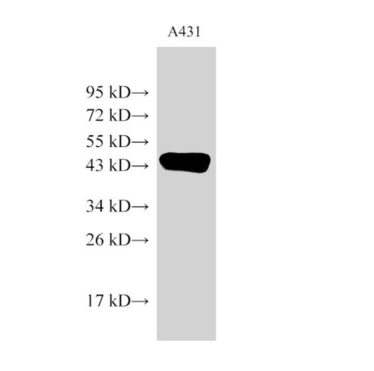 Western Blot analysis of A431 cells using beta actin Polyclonal Antibody at dilution of 1:2000