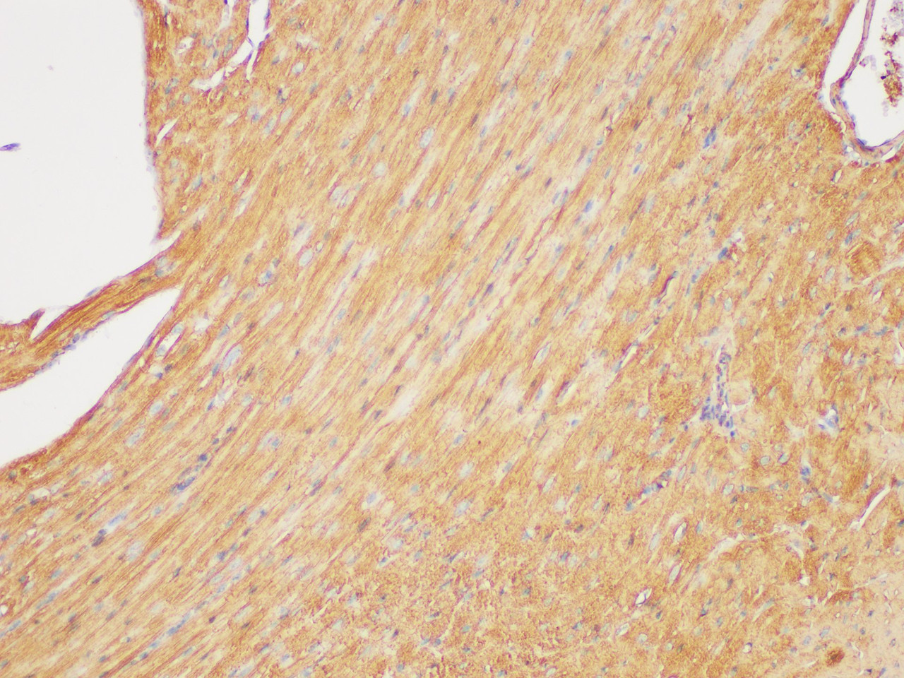 Immunohistochemistry of paraffin-embedded Mouse heart using beta actin Polyclonal Antibody at dilution of 1:200