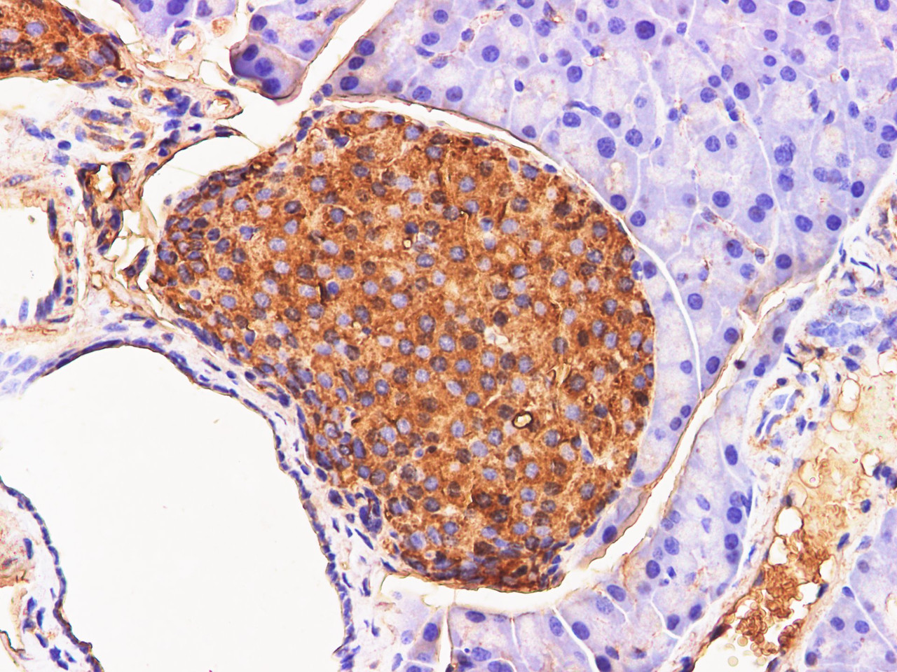 https://file.elabscience.com//image/antibody/EA/E-AB-40339-IHC03.jpg