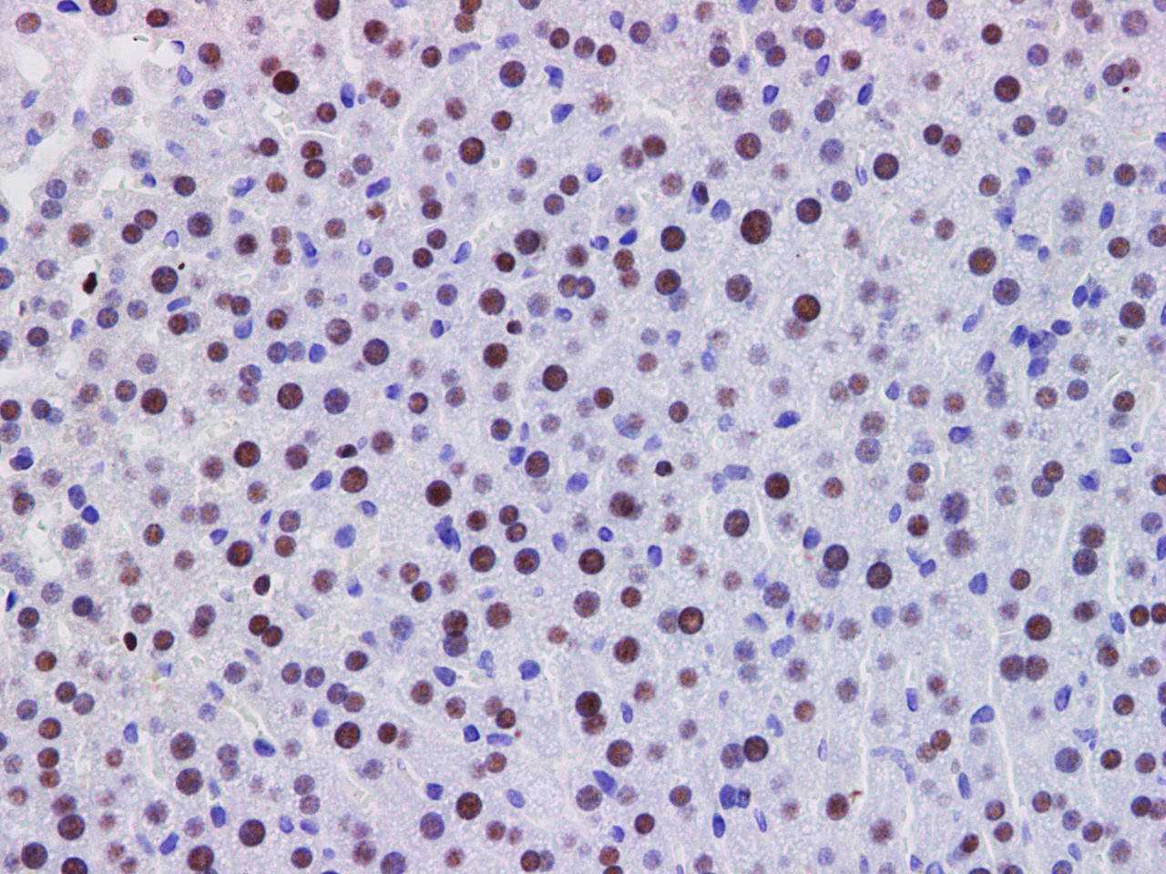 https://file.elabscience.com//image/antibody/EA/E-AB-40340-IHC01.jpg