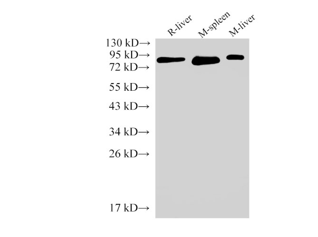 Western Blot analysis of Rat liver, Mouse spleen and Mouse liver using IL6R Polyclonal Antibody at dilution of 1:2000