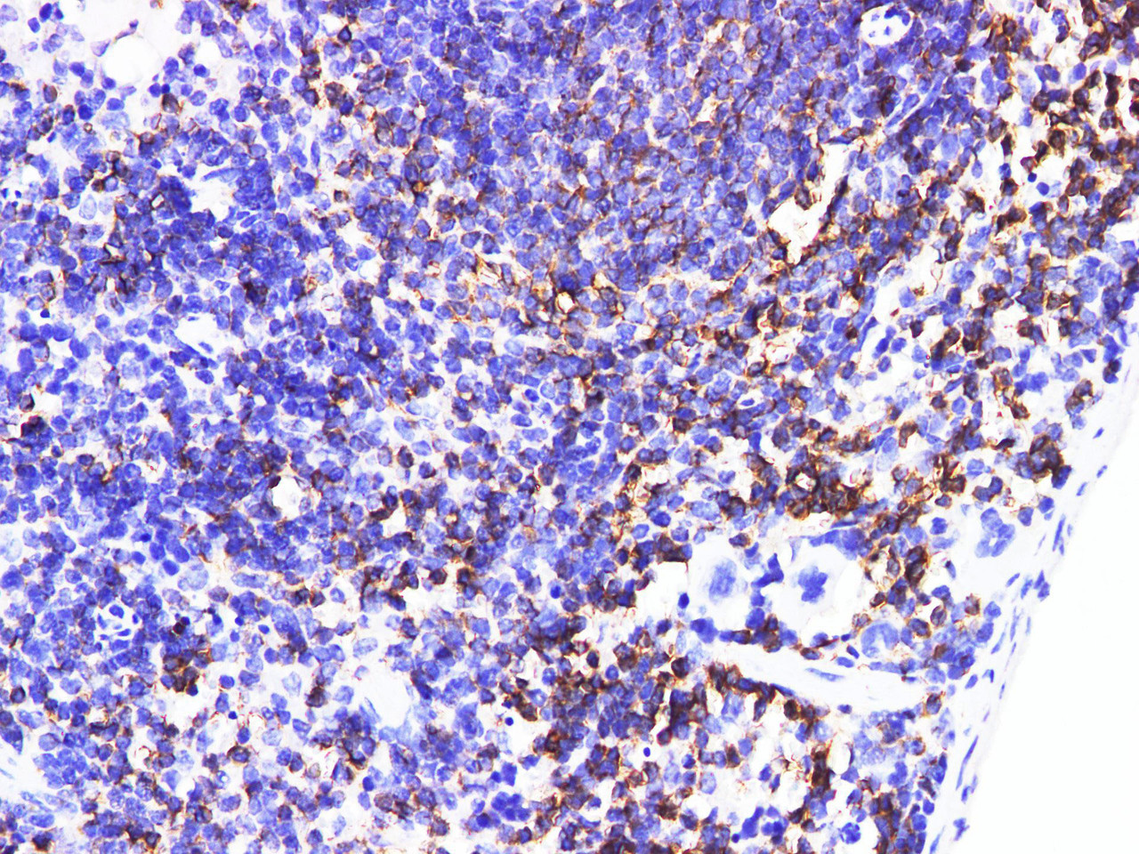 https://file.elabscience.com//image/antibody/EA/E-AB-40344-IHC01.jpg